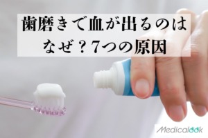 歯磨きで血が出るのはなぜ？毎回・大量に出るときに考えられる7つの原因【歯科医監修】