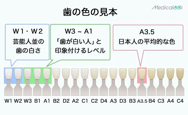 画像あり】歯の黄ばみレベルをチェック！自分で白くできる？ | Medicalook(メディカルック)