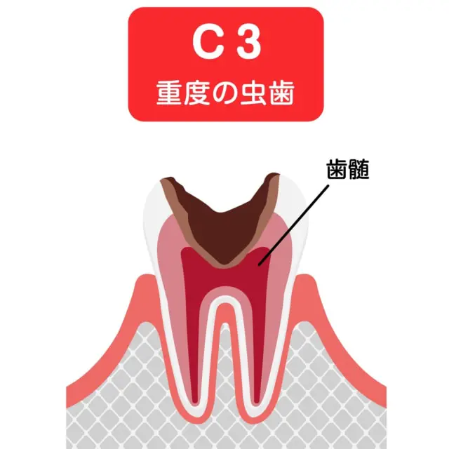 自分で治せる! 歯医者で良くならない症状の原因は歯にない 「非患部原性」疾患「… Amazon.co.jp: 自分で治せる! (歯医者で良くならない症状の原因