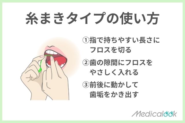 糸まきタイプ（ロールタイプ）の使い方