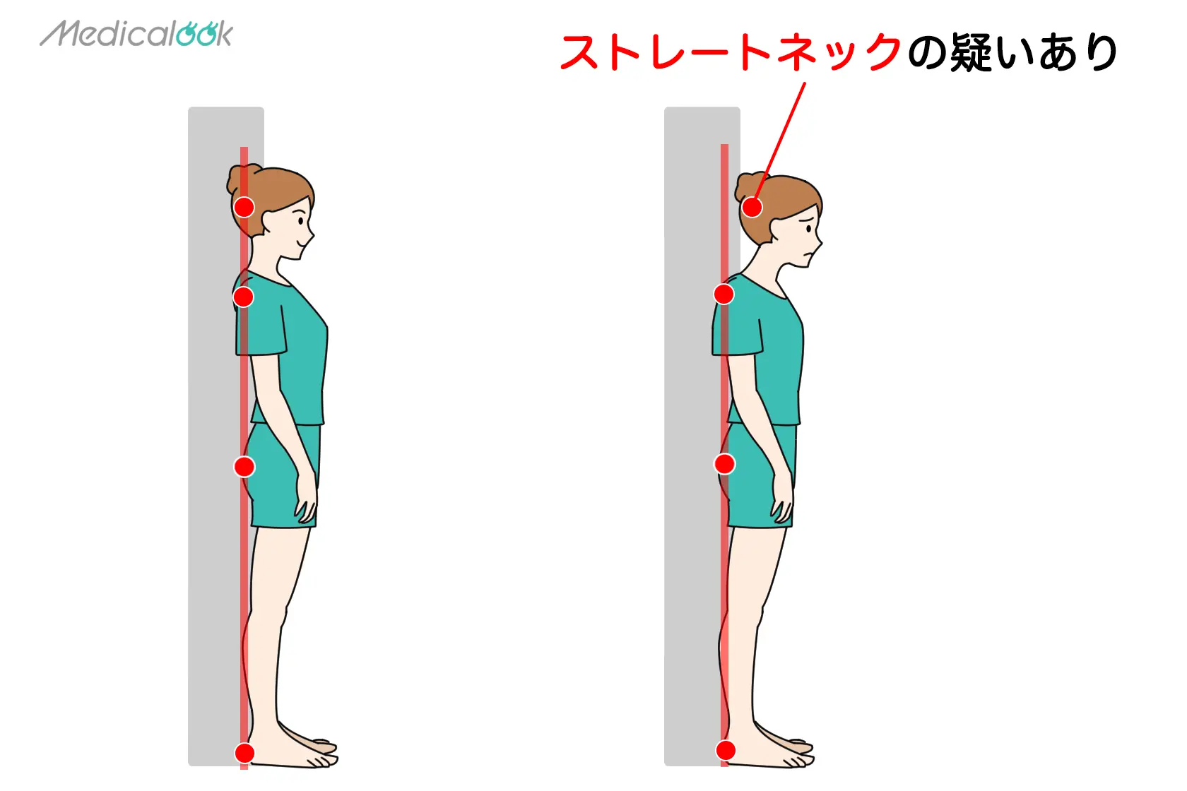 https://medicalook.jp/wp-content/uploads/2022/05/straight-neck-check.jpg.webp