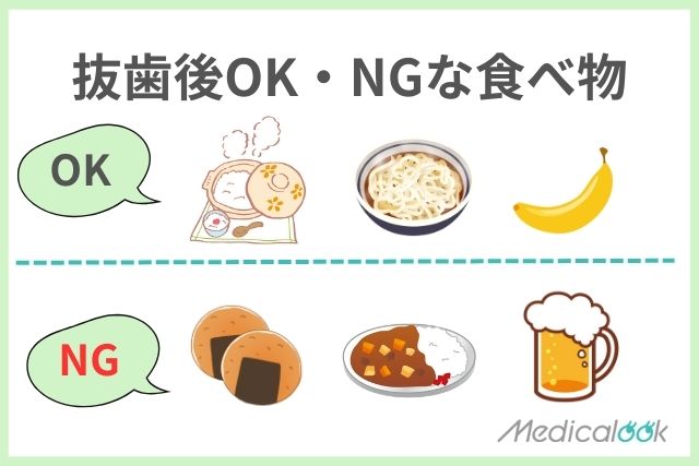抜歯後に食べてよいものと悪いもの