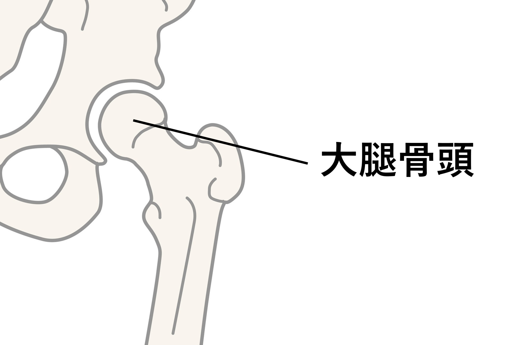 大腿骨頭